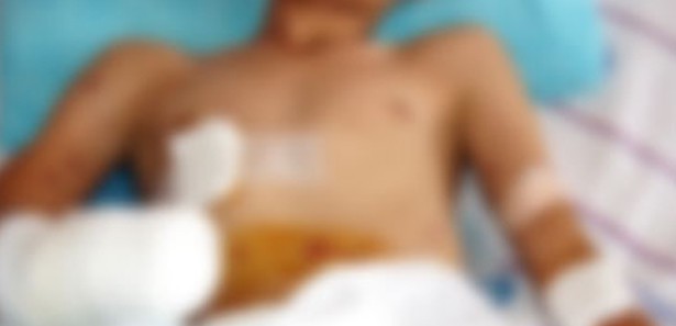 Bıçaklanan Asker Kızılca da Toprağa Verildi