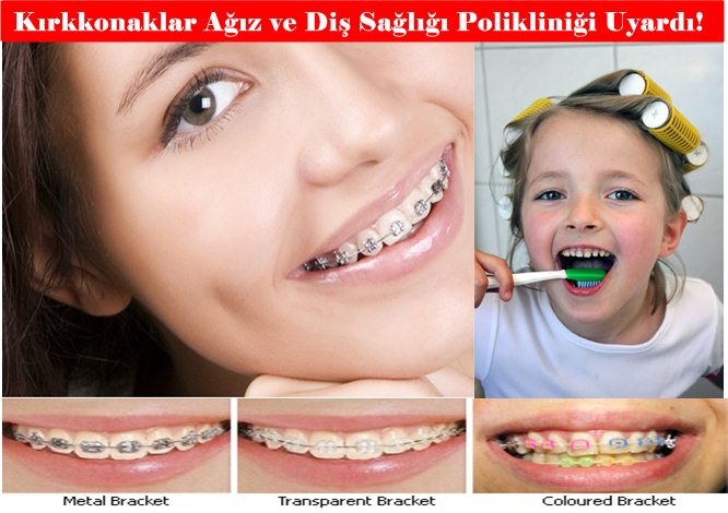 Kırkkonaklar Diş Polikliniği Uyardı: Çocuğunuzun diş tedavisinde geç kalmayın