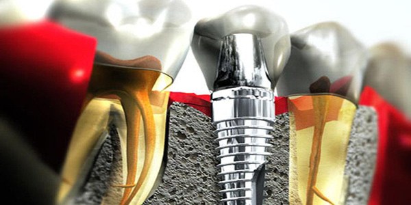 MİLLETE YOK VEKİLE İSE SAY SAY BİTMEZ...