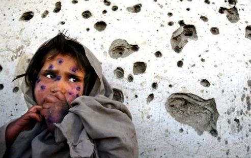 İSRAİL VURUYOR …DÜNYA İZLİYOR