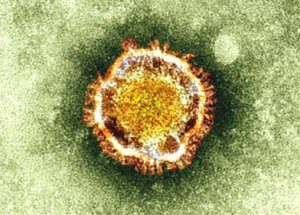 Ölümcül Virüs Yeniden Ortaya Çıktı